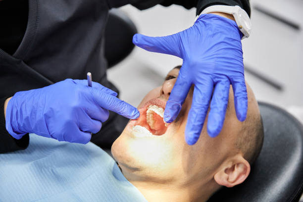 Best Emergency Dentist for Lost Fillings or Crowns in Terrace Park, OH