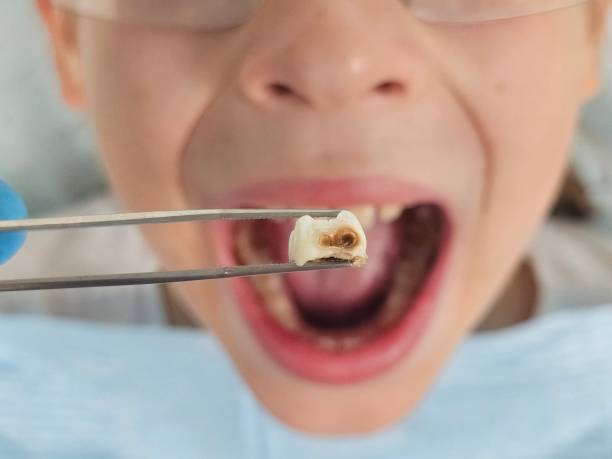 Best Urgent Dental Care for Toothache in Terrace Park, OH